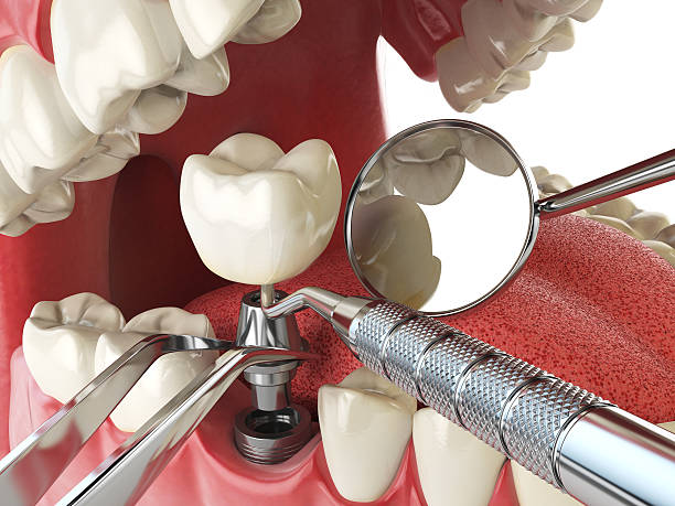 Urgent Tooth Repair in VA